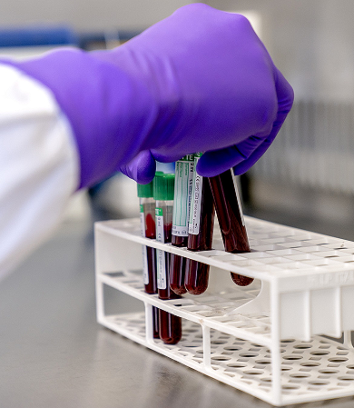 Nieuwe test voor lymeziekte niet betrouwbaar