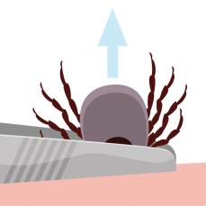 Trek de pincet met teek omhoog, niet draaien